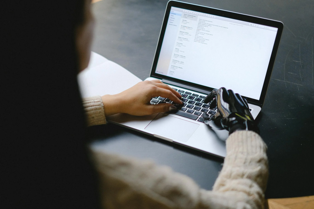 A woman with a bionic arm using a laptop